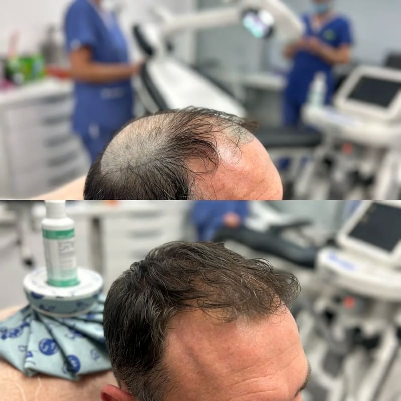 Instructie voor en na de ingreep